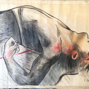 HOMBRE SANGRANDO FRENTE DETR?S DE OREJA HOMBRO - SIN MARCO